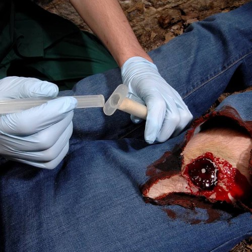 Аппликатор гемостатический с гранулами Rhino Rescue в Новокузнецке хитозановый